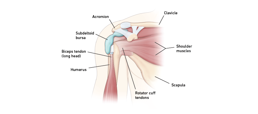 Pain in shoulder graphic