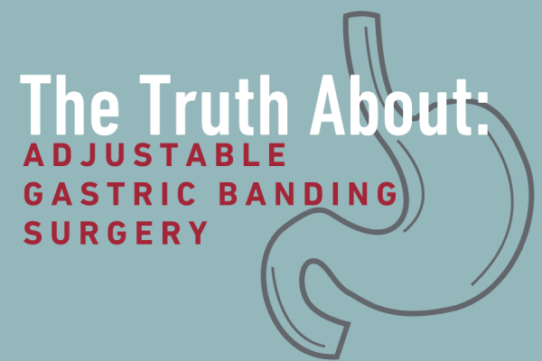 Adjustable Gastric Banding Surgery graphic