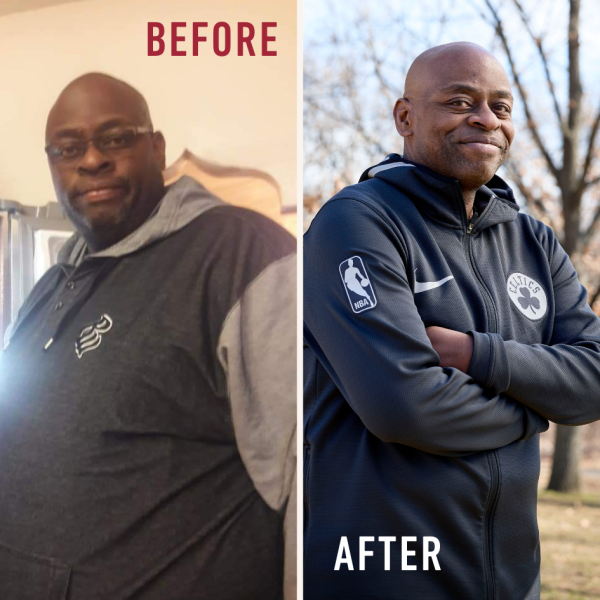 Leonard before and after