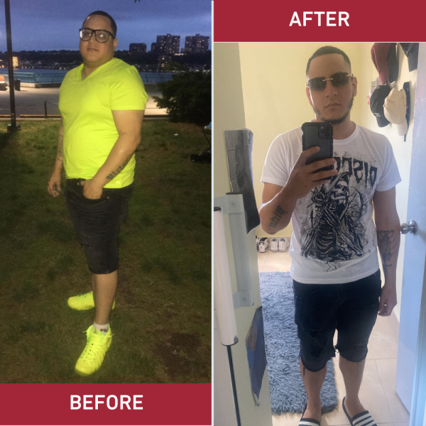 Victor before and after bariatric surgery