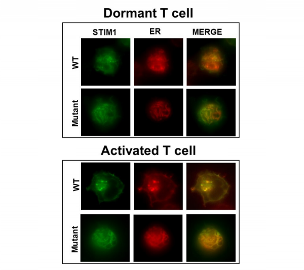 Stim 1 mitochondrial function during t cell activation